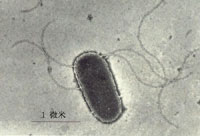 用负染法制备电子显微镜下观察到的大肠杆菌鞭毛