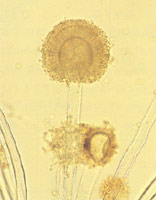 显微镜下黄曲霉的孢子囊
